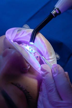 Dental Laser Treatment