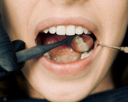 Gum treatment (periodontics)
